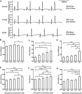 Acute osimertinib exposure induces electrocardiac changes by synchronously inhibiting the currents of cardiac ion channels